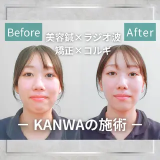 KANWA 鍼灸院のエステ・リラクイメージ