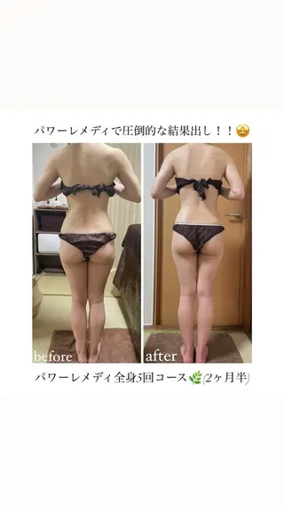 《本気痩せ×疲労改善 》  BILOOPのエステ・リラクイメージ