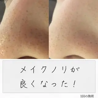 ニキビ経験者が施術 する専門サロン🌻のエステ・リラクイメージ