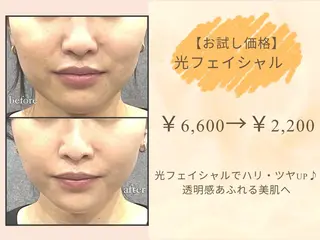 MIU Rimの眉毛・アイブロウイメージ