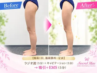 セルフエステ専門店 🌈Logeのエステ・リラクイメージ