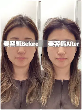 ハリサロンドオフ 美容鍼灸×小顔整体のエステ・リラクイメージ
