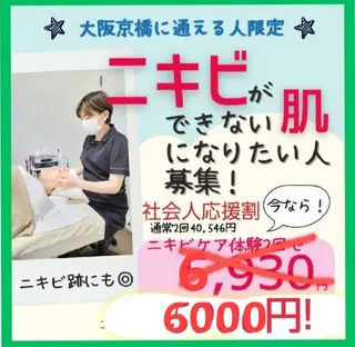 ニキビケア◇ニキビ跡 レゾン京橋店 峠山のエステ・リラクイメージ