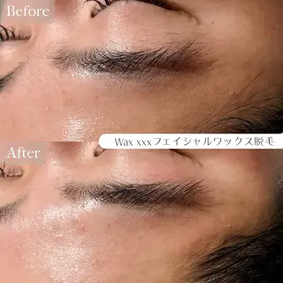 ルコル池袋【毛穴洗浄 /wax顔脱毛】えみのエステ・リラクイメージ