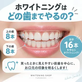 ホワイトニング ショップ船橋店のエステ・リラクイメージ