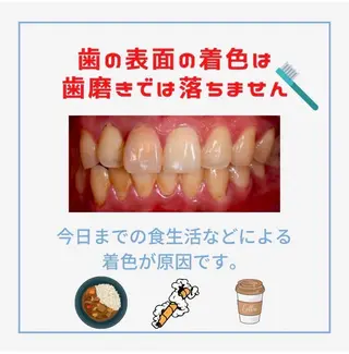 メンズ ホワイトニング ショップ千葉店のその他イメージ