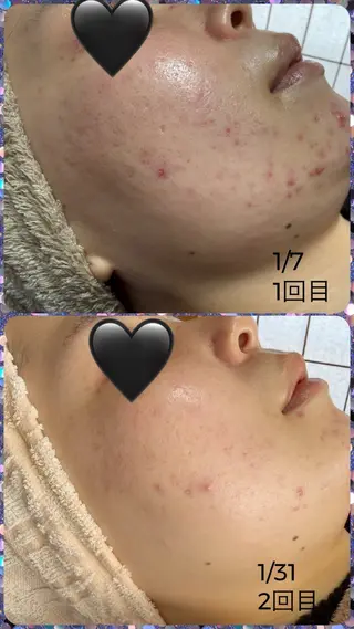 COCO beautyサロンのエステ・リラクイメージ