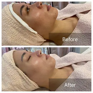 Lis Rose🥀 フェイシャルサロンのエステ・リラクイメージ