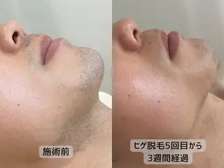 メンズ 美肌❤️美眉 結果重視サロン✨のエステ・リラクイメージ