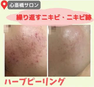 心斎橋/美肌管理専門 muroのエステ・リラクイメージ