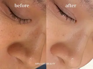 OPS×LIFE BEAUTY/maiのエステ・リラクイメージ