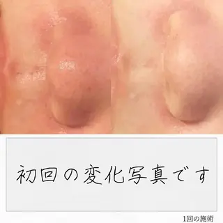 ニキビ経験者が施術 する専門サロン🌻のエステ・リラクイメージ