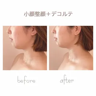 小顔＆美肌 Re :setのエステ・リラクイメージ