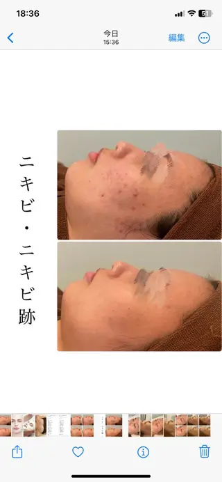 ハーブピーリング専門 BIOPLUS+川崎のエステ・リラクイメージ
