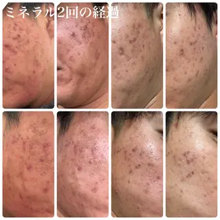 毛穴・肌質改善サロン ✨Tomaのエステ・リラクイメージ