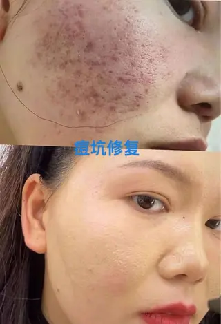 マツエク・マツパ 愛維美水光専門店 川崎彩鳳のエステ・リラクイメージ