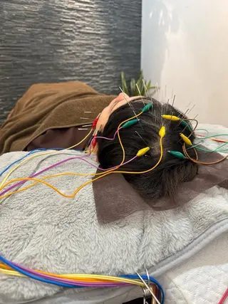 小顔矯/美容鍼/鍼灸 BeauJuのその他イメージ