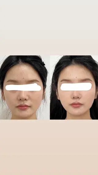 マツエク・マツパ 愛維美水光美肌専門店 メンズレディースokのエステ・リラクイメージ