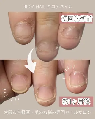 ネイル KIKOA NAIL キコアネイルのネイルデザイン