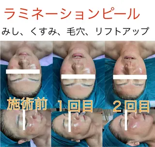 Corazon コラゾンのマツエク・マツパデザイン