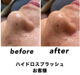 ネイル・エステサロン UILANIのエステ・リラクイメージ