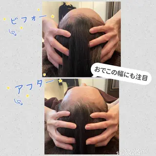 強めリンパマッサージ 肩こり/麻布十番/のエステ・リラクイメージ