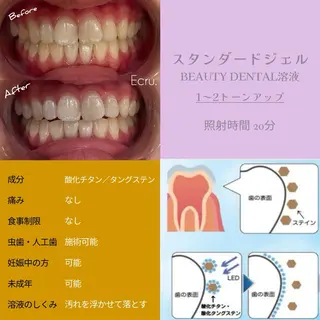 メンズ キッズ ホワイトニングサロン Ecru エクリュのその他イメージ