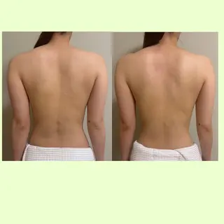 spaHINOKI 【女性専用】のエステ・リラクイメージ
