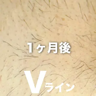 豊橋 |Hitomi シュガーリング専門店のその他イメージ