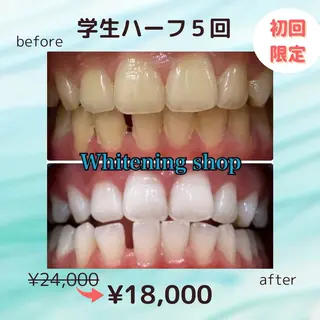 メンズ ホワイトニング ショップ高田馬場店のその他イメージ