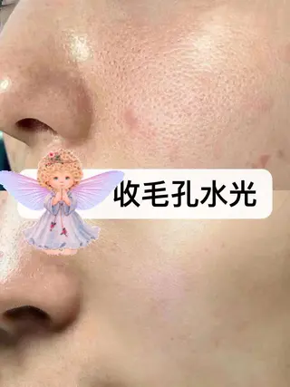 ネイル 愛維美水光専門店 川崎彩鳳のエステ・リラクイメージ