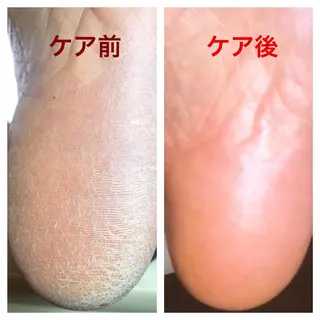 ショート カラー メンズ キッズ ネイル 🌱 ま し お 🌱のエステ・リラクイメージ