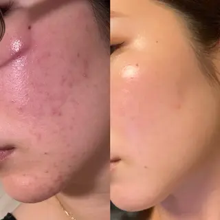 岡崎🦋SOYOU 韓国肌管理のエステ・リラクイメージ