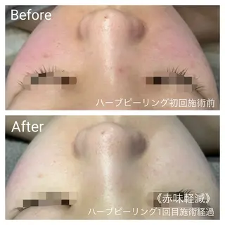 深い肌悩み&早期脱毛 完了サロンのエステ・リラクイメージ