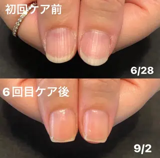 ネイル 地爪育成💅 kanaoanailのネイルデザイン