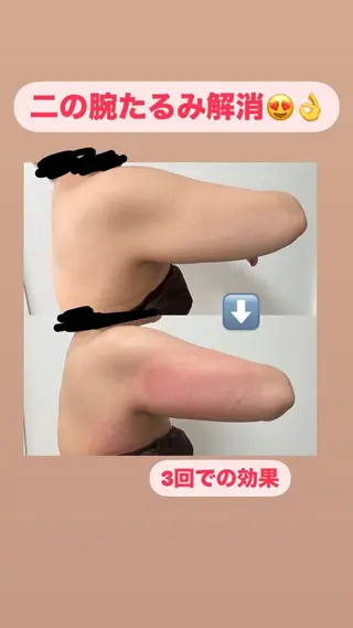 石巻 冷却痩身 Miiju. 鈴木のエステ・リラクイメージ
