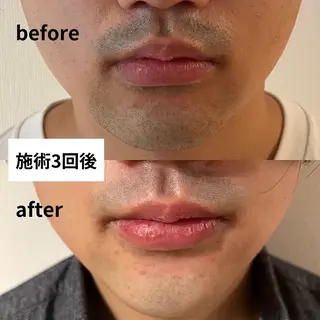 メンズ メンズ脱毛サロン 上岡　翼のエステ・リラクイメージ