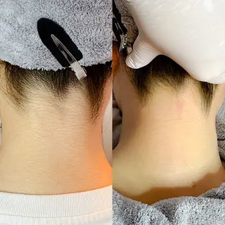 豊橋 ｜Hitomi シュガーリング専門店のその他イメージ