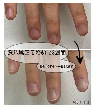 ネイル nail salon petillantのネイルデザイン