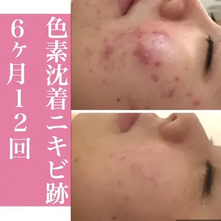 ミディアム カラー パーマ ヘアアレンジ メンズ キッズ ネイル マツエク・マツパ アイブロウ ニキビ・肌質改善専門 ♡人生が変わるサロンのエステ・リラクイメージ