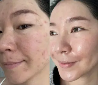 マツエク・マツパ 愛維美水光専門店 川崎彩鳳のエステ・リラクイメージ