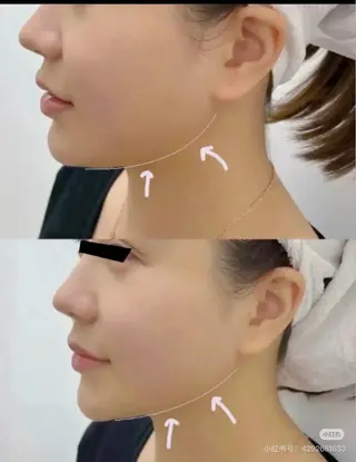 マツエク・マツパ 愛維美水光専門店 川崎彩鳳のエステ・リラクイメージ