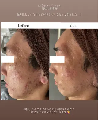 Dahlia痩身脱毛 フェイシャル 中村のエステ・リラクイメージ