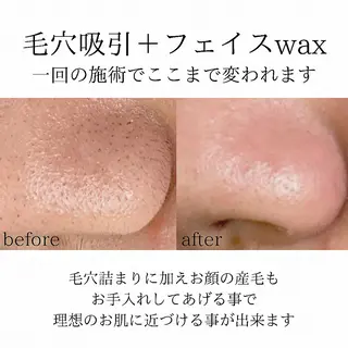 メンズ 稲嶺 美華のエステ・リラクイメージ