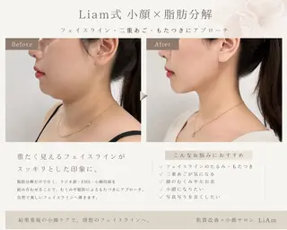 LiAm《美肌管理/ 小顔/脂肪ケア》のエステ・リラクイメージ