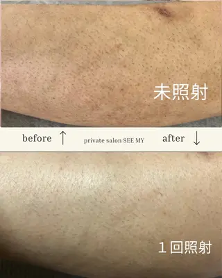 SEE MYのエステ・リラクイメージ