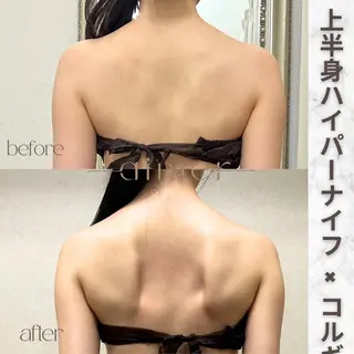 aimer服部 /  小顔 ・ 痩身のその他イメージ