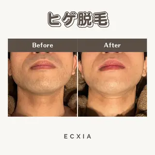 メンズ メンズ脱毛サロン ECXIA 博多のエステ・リラクイメージ