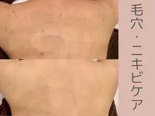 小顔/毛穴/ニキビ salon bealのエステ・リラクイメージ