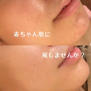 触れたくなる モテ肌へ...❤︎のエステ・リラクイメージ